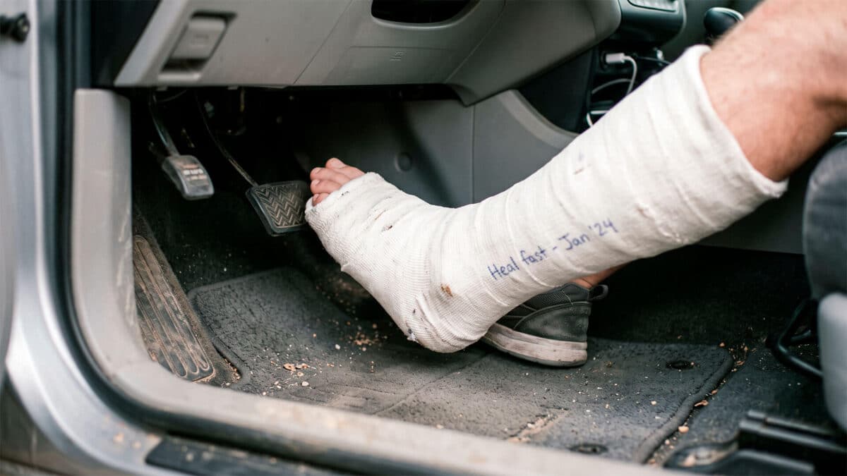 Pie escayolado intentando pisar los pedales de un coche en el asiento del conductor.